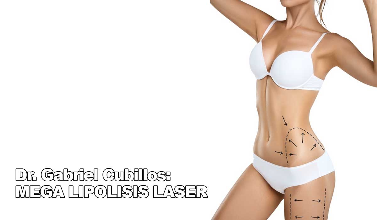 Dr. Gabriel Cubillos analiza las ventajas de la lipolisis láser