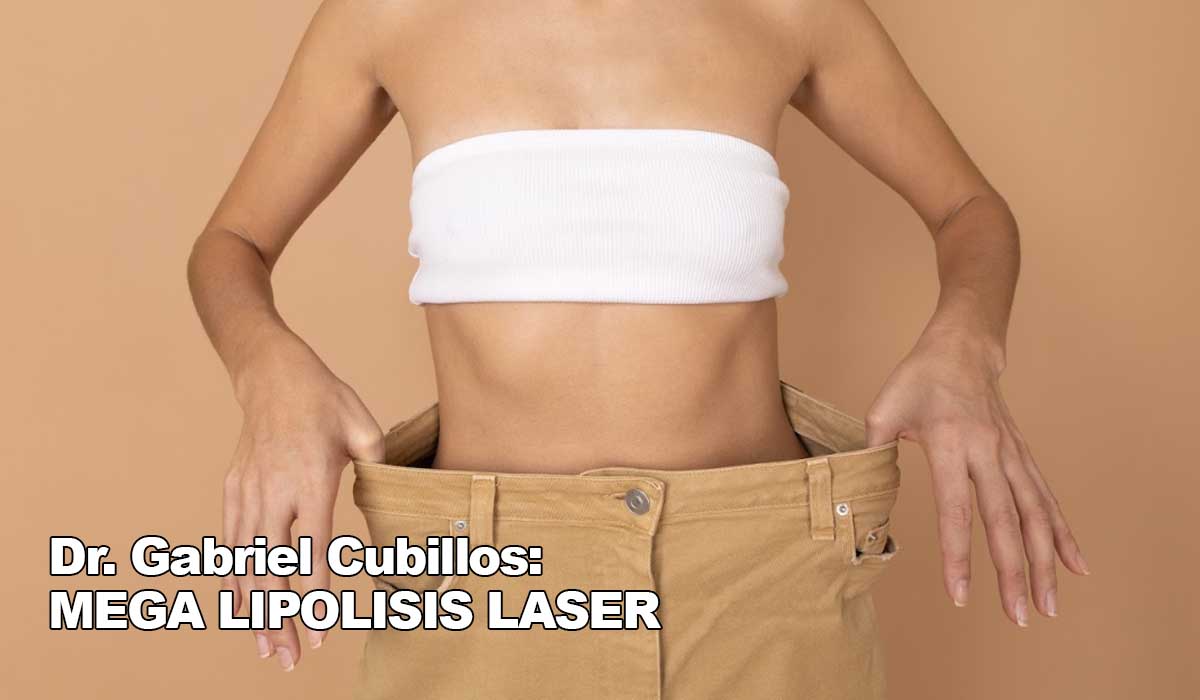 Los beneficios de la lipolisis láser según el Dr. Gabriel Cubillos: una visión innovadora