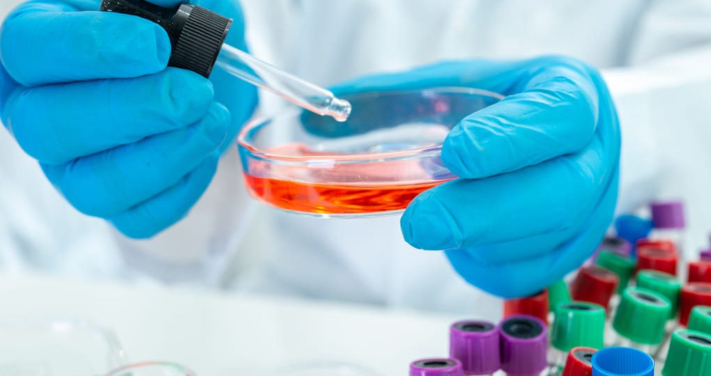 Guía completa de tratamientos para Duchenne (DMD) en Guatemala